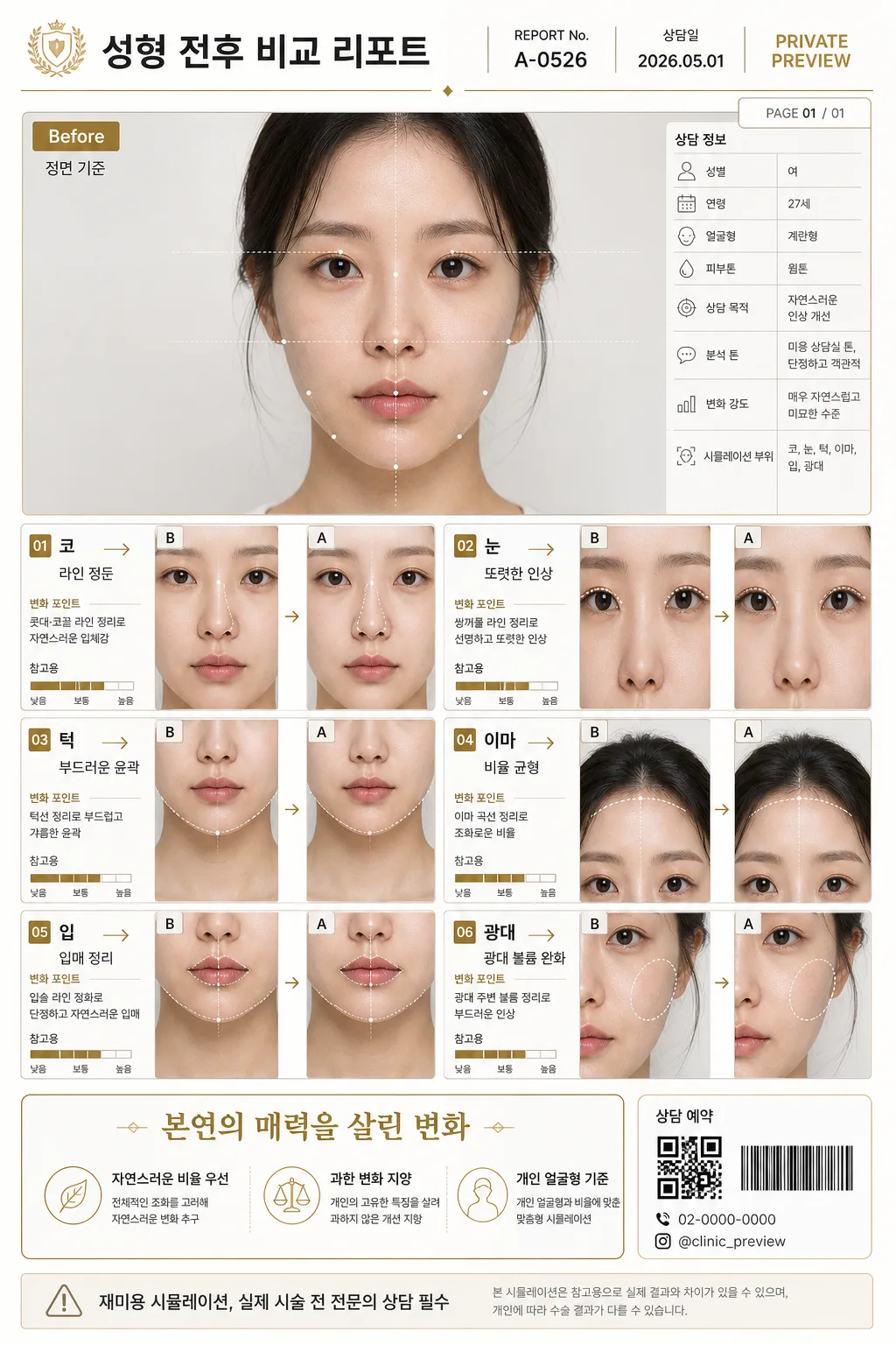 성형 전후 비교 리포트 提示詞預覽